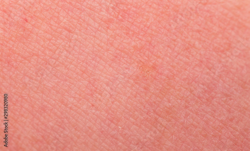 Sunburn skin as a texture or background. Selective focus. Extreme macro