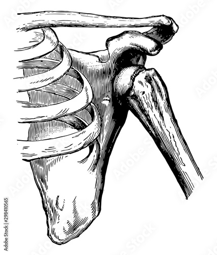 Dislocation of the Humerus, vintage illustration.