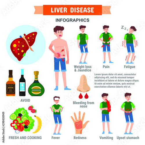 Liver disease Infographic Template Design. health concept. sign and symptoms of liver disease. Liver Cancer Symptoms Causes Risk Factors. Vector flat icons cartoon design eps10 illustration.