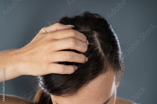 Woman Scratching Her Itchy Head