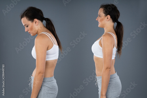 Woman With Lordosis And Normal Curvature photo