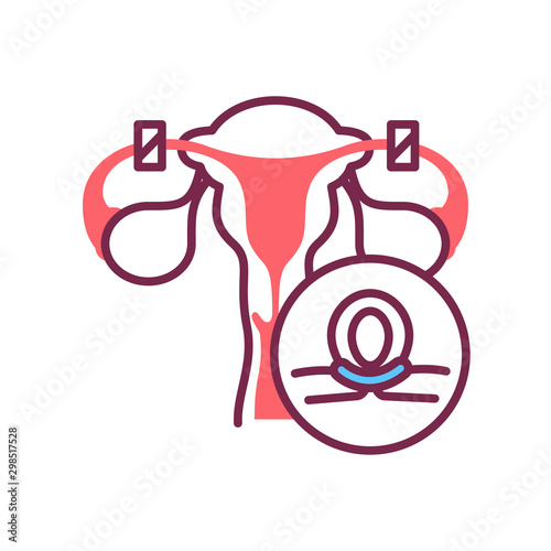 Female sterilization color line icon. Tubal ligation. photo