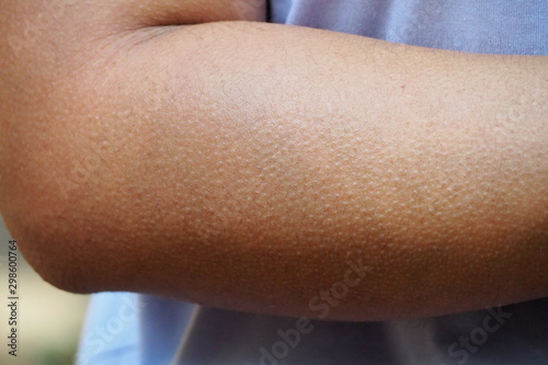 Human skin getting goosebumps on arm when feeling cold or creepy seeing something haunted or shocked. Human mechanism to protect body from such strong emotional environment. 