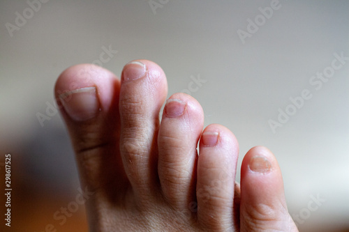 young girl's toes are healthy and beautiful.