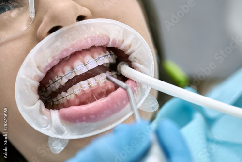 Pretty woman's teeth cleaning in dental clinic