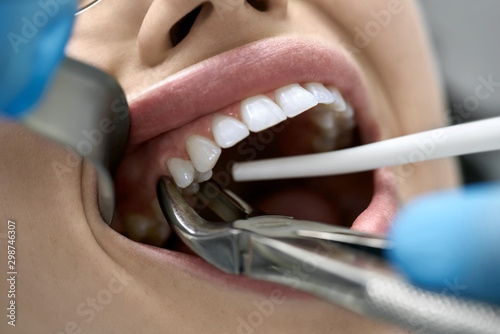 Fotografiet Pretty woman's teeth treatment in dental clinic