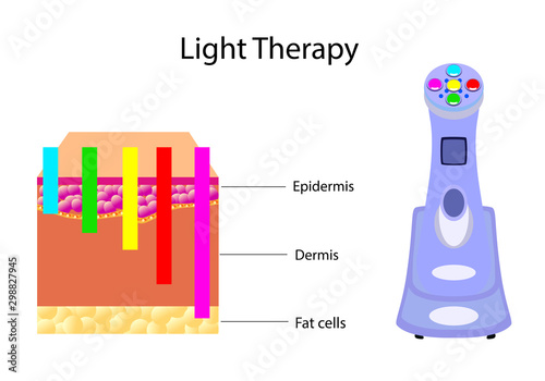 Gadget for Light Therapy and chart, vector illustration