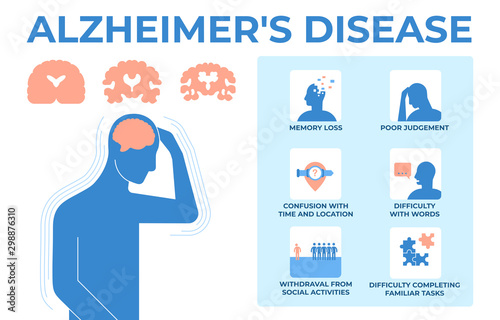 Flat vector infographic of symptoms Alzheimer s disease
