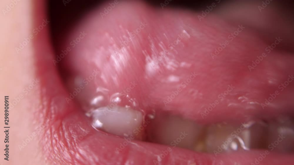 Baby teeth macro shoot. Toothless smile. A wobbly tooth. Cutting root tooth. Tongue in the hole between the teeth. Baby teeth macro shoot. Toothless smile. A wobbly tooth. Cutting root tooth. Tongue in the hole between the teeth.
