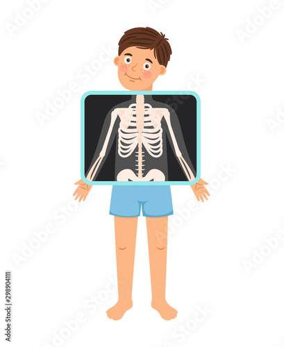 Boy x-ray. Cartoon kid patient xray, naked child skeleton bones snapshot for clinic doctor vector illustration