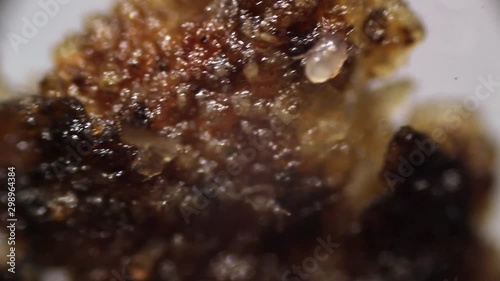 live specimens of otodectes cynotis also known as ear mite. Taken from ear of homeless cat.