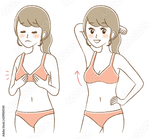 Illustration of breast augmentation surgery