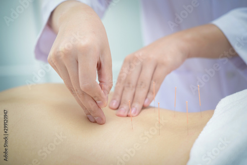 Closeup, patient getting acupuncture from acupuncturist at clinic for chinese medicine treatment.
