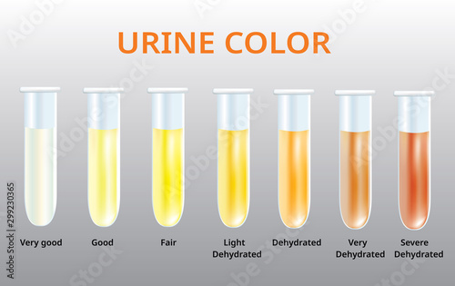 Urine color chart, Urine in Test tubes, medical vector