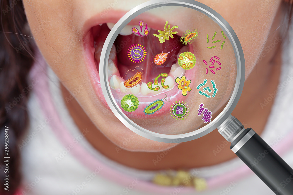 Mouth Bacteria And Diseases In Magnifying Glass Dental Hygiene Stock 