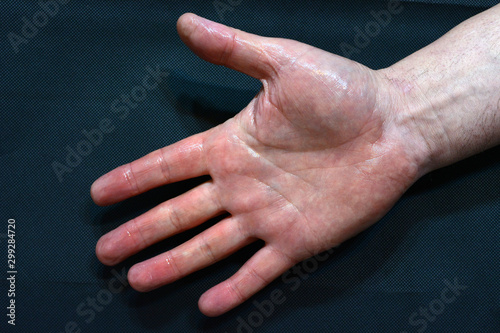 Wet skin open hand image