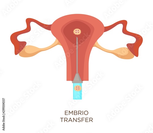 Embryo transfer artificial insemination uterus and ovum isolated organ