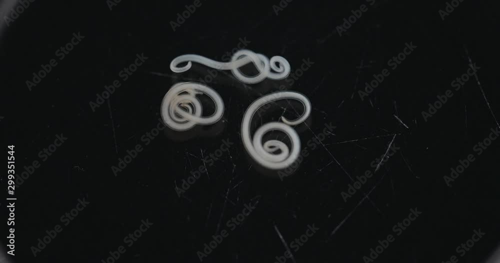 Ascariasis is a disease caused by the parasitic roundworm Ascaris lumbricoides for education in laboratories.