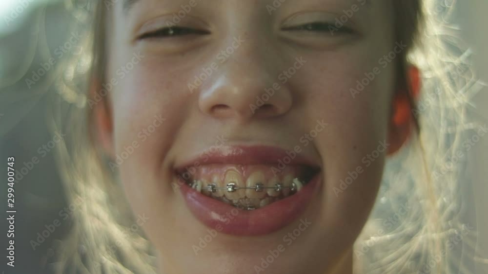 Funny Rude Nature Teenage Girl Wearing Metal Braces ...