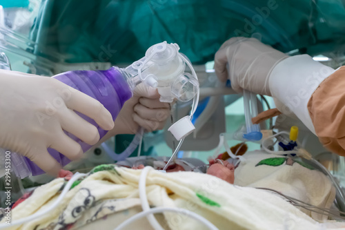 Critically ill Baby inside a covered incubator, assisted ventilation through orotraqueal tube by physician. Nurse and doctor´s hands with gloves. NICU. photo