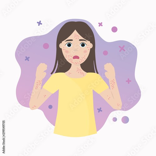 The concept of allergy. Skin problems, rashes, acne, pimples. Vector illustration.