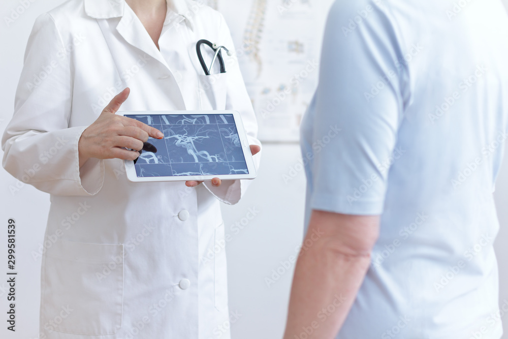 Stroke prevention concept: doctor with tablet pc showing her patient an mra image of her cerebral blood vessels. Stroke prevention concept: doctor with tablet pc showing her patient an mra image of her cerebral blood vessels.