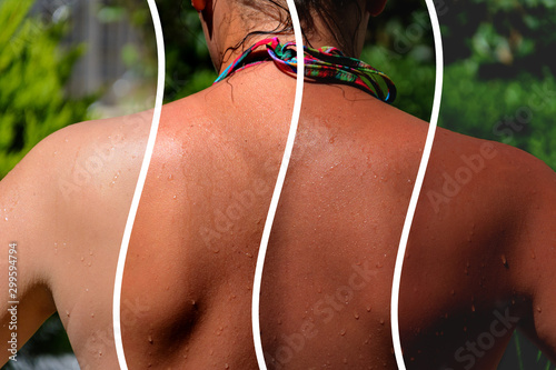 photo collage. back of a girl in a bikini with a demonstration of different shades of tan photo