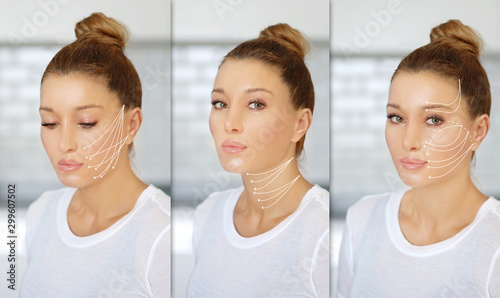 Obraz na plátně Thread Lift ,markup
