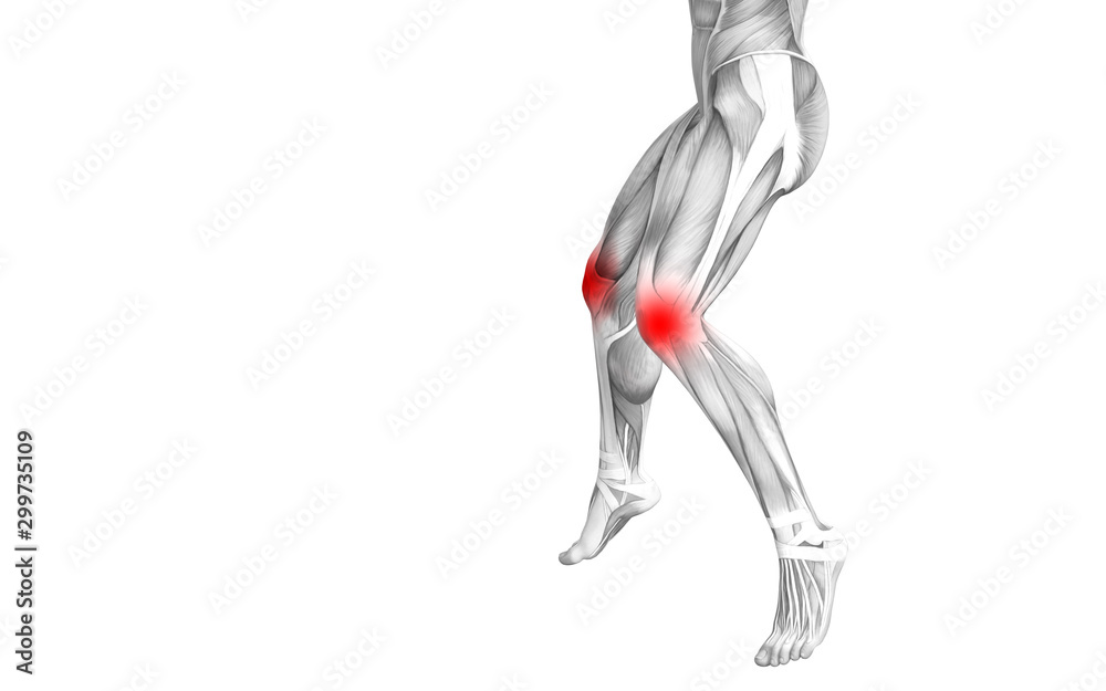Conceptual knee human anatomy with red hot spot inflammation or articular joint pain for leg health care therapy or sport muscle concepts. 3D illustration man arthritis or bone osteoporosis disease Conceptual knee human anatomy with red hot spot inflammation or articular joint pain for leg health care therapy or sport muscle concepts. 3D illustration man arthritis or bone osteoporosis disease