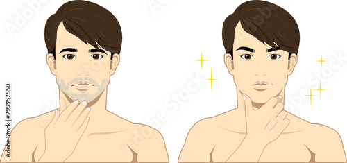 男性 美容 肌 スキンケア 脱毛 ビフォー アフター02