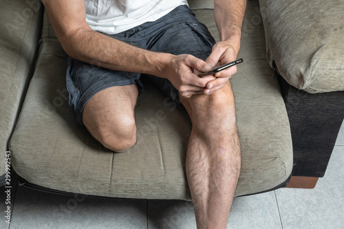 Young man with leg amputation sitting on sofa with mobile phone in hand