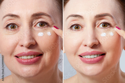 Close-up macro before after portrait of middle aged woman with face cream isolated on white background. Wrinkles and menopause. Collagen and plastic surgery. Anti aging concept. White teeth smile