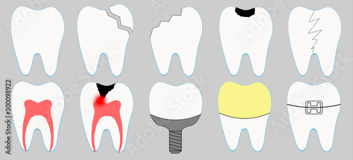 Set of cute cartoon tooth icons. Different tooth conditions. Healthy and bad teeth. Dentist and stomatology icon collection - orthodontics  caries  implant  crown  pulpits  fracture