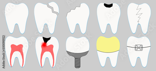 Tableau sur toile Set of cute cartoon tooth icons