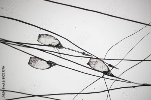 Lice egg attached to the hair, photo taken with a high magnification microscope.