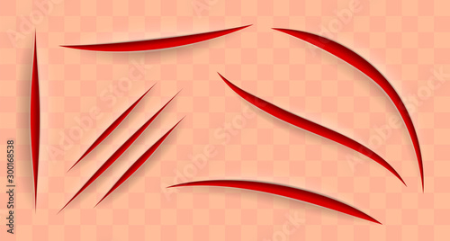 Skin wounds set. Realistic lacerations and injuries on transparent background. Vector medical design elements.