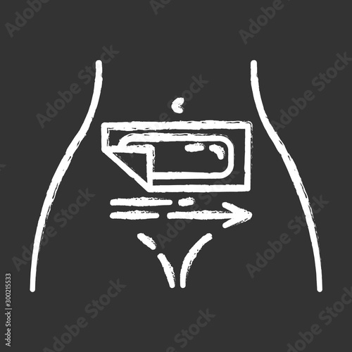 Belly waxing chalk icon. Female hair removal procedure. Depilation with natural soft, cold wax strip. Professional beauty treatment. Clean and silky skin. Isolated vector chalkboard illustration