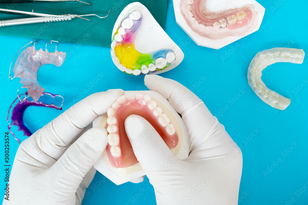 Complete denture or full denture on blue background. Stock Photo