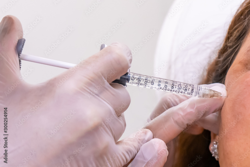 Gloved doctor hand injecting a vial of hyaluronic acid (HA) based dermal filler into patient for a non-surgical cheek and face lift. Gloved doctor hand injecting a vial of hyaluronic acid (HA) based dermal filler into patient for a non-surgical cheek and face lift.
