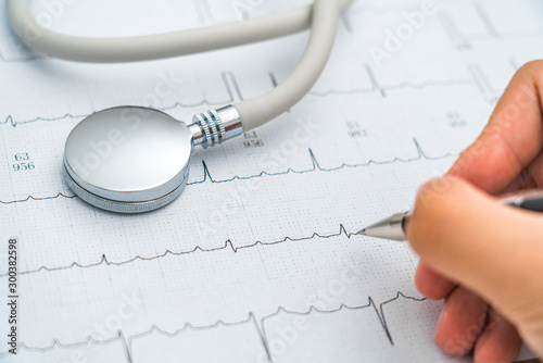 Stethoscope and a pen in the background of electrocardiographic drawing photo