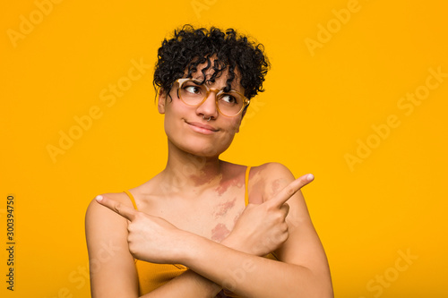 Young african american woman with skin birth mark points sideways, is trying to choose between two options.
