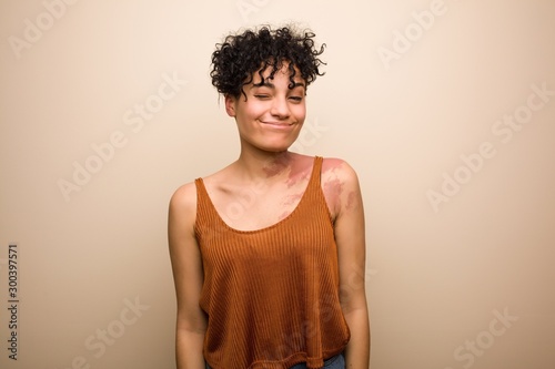 Young beautiful and natural african american woman with a birthmark