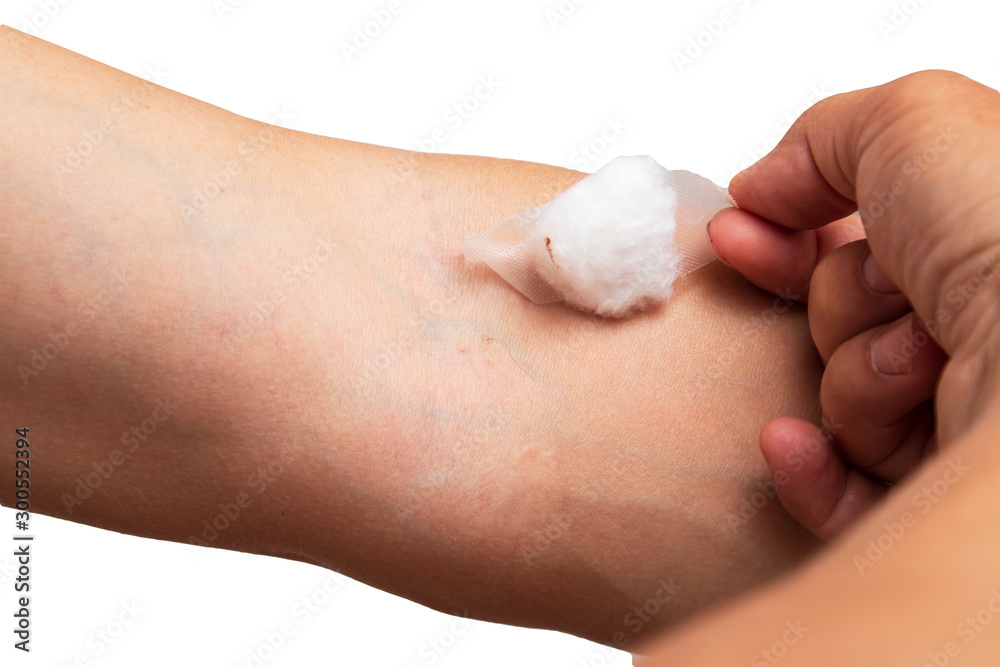 stab from the injection on the hand with cotton stab from the injection on the hand with cotton