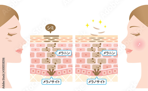 ターンオーバー　肌の断面図と女性