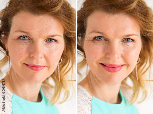 Konstfotografi Woman's portrait before and after bigger lips enhancement procedure