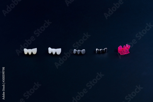 different types of dental tooth crowns