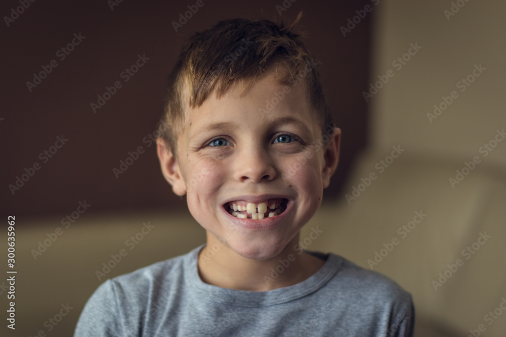8 years old kid, european blond boy showing his mouth open, temporary baby milk teeth missing, childhood and dentistry or medical concept, tooth care, natural light shot at daytime 8 years old kid, european blond boy showing his mouth open, temporary baby milk teeth missing, childhood and dentistry or medical concept, tooth care, natural light shot at daytime