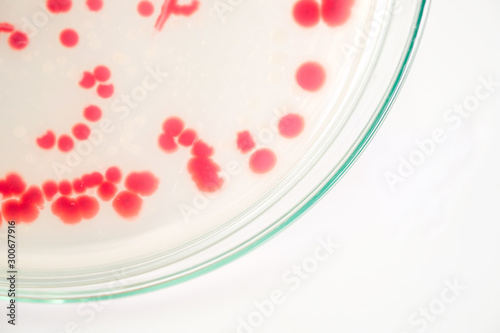 red colony of bacteria in laboratory