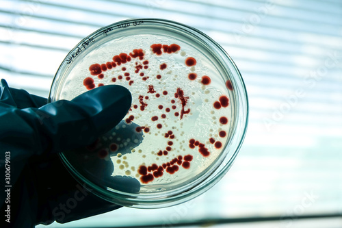 red colony of bacteria in laboratory