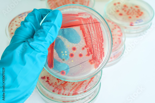 red colony of bacteria in laboratory